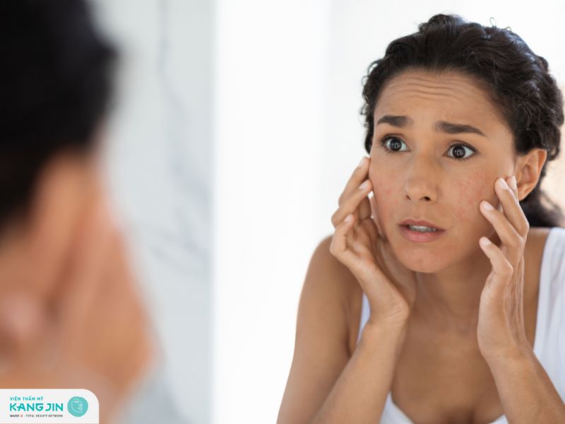 Tổng hợp công thức mặt nạ dưỡng ẩm cho da mặt nhạy cảm 