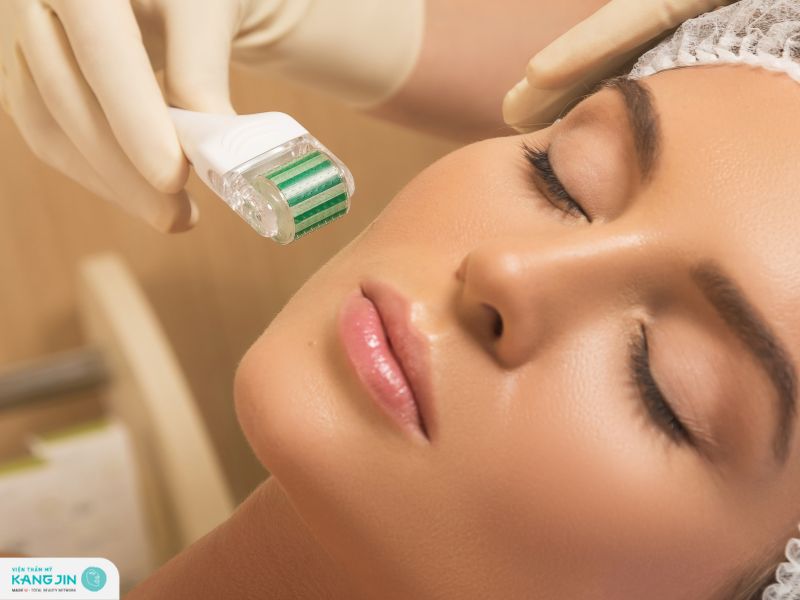 lăn kim tái tạo da