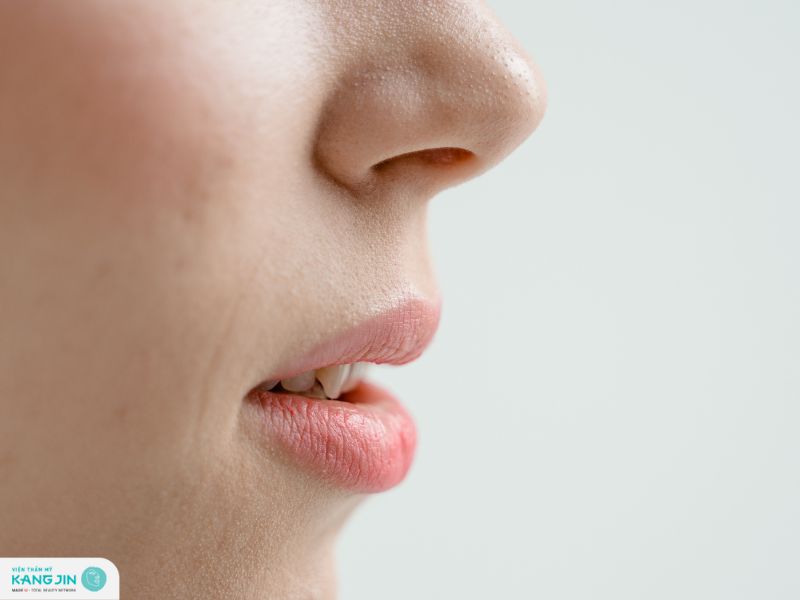 lăn kim tái tạo da