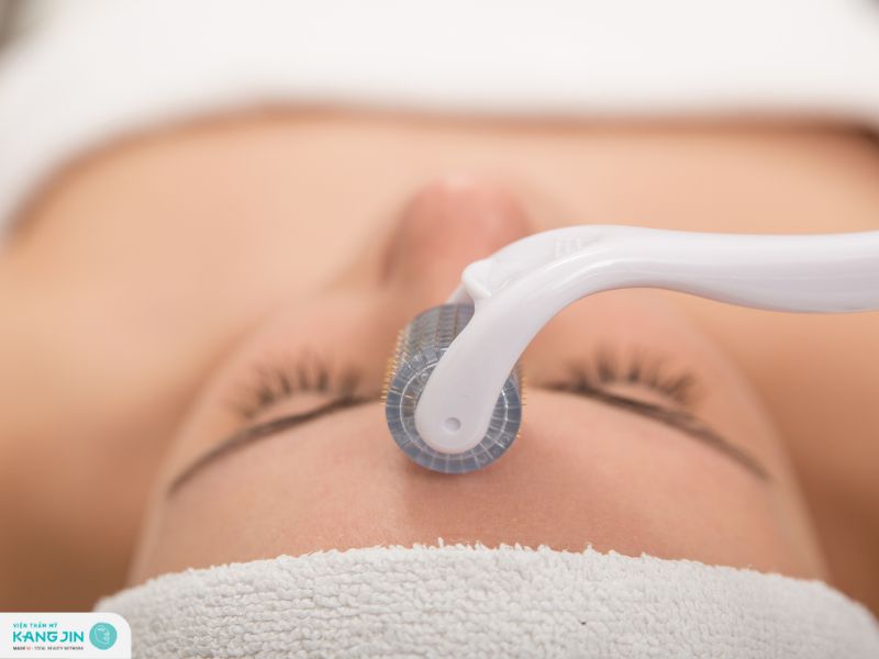 lăn kim tái tạo da