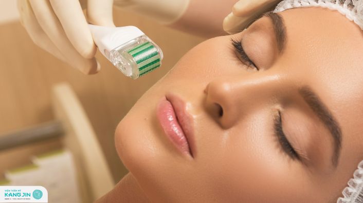 lăn kim tái tạo da