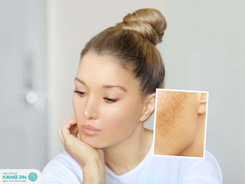 Tổng hợp nguyên nhân da mặt bị sạm đen