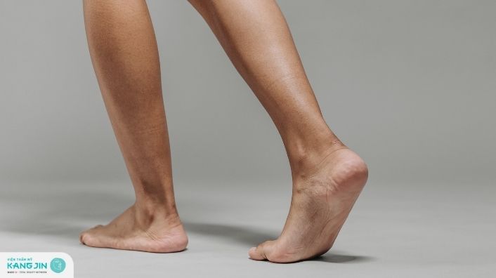 Chân đen: Nguyên nhân và cách giúp cải thiện hiệu quả tại nhà