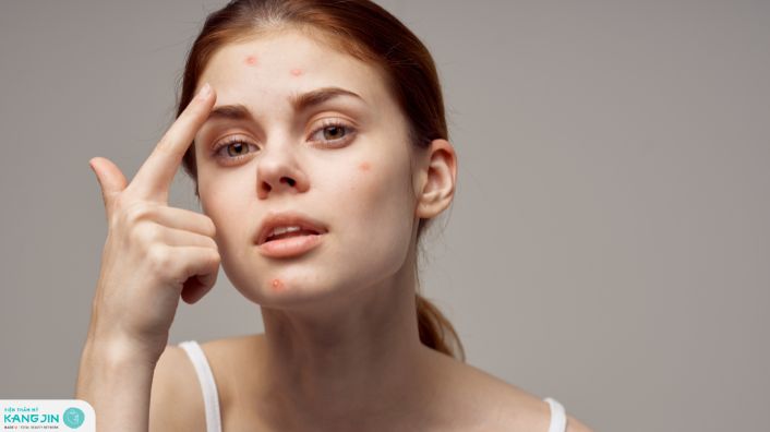 dưỡng ẩm quá nhiều