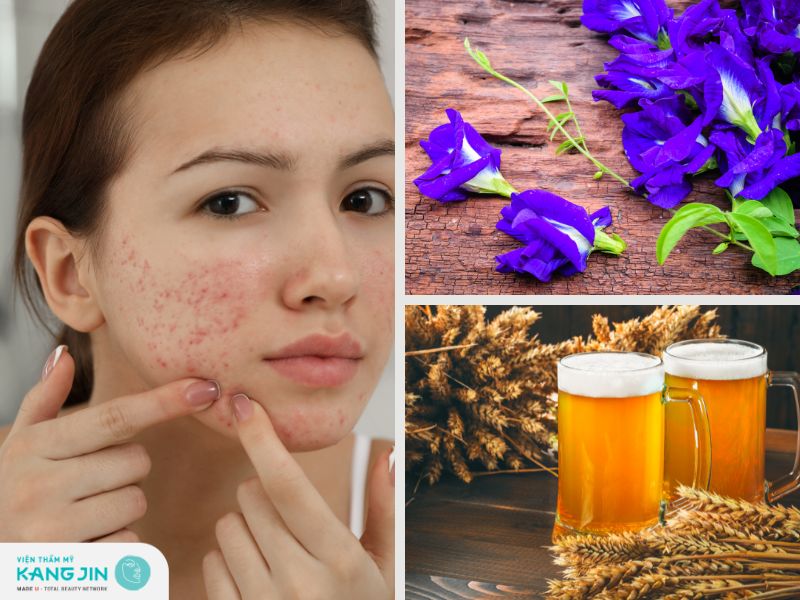 Mặt nạ hoa đậu biếc và bia ngăn ngừa thâm mụn 