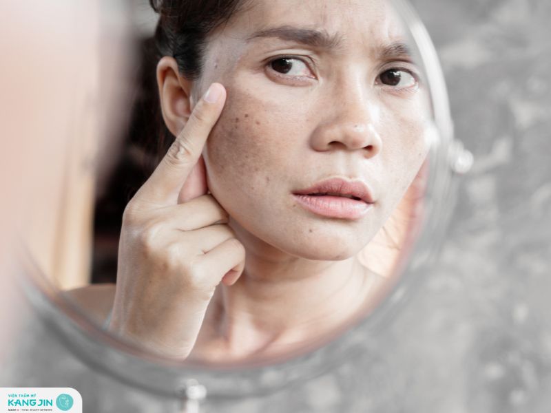 nám có trị tận gốc được không