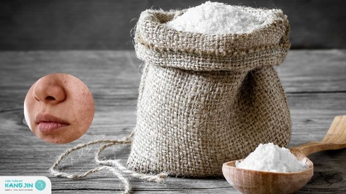 7 Mẹo trị mụn đầu đen ở mũi bằng muối