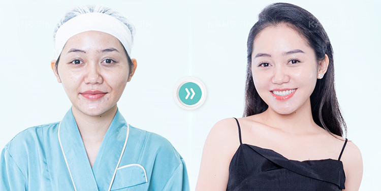 Hàng ngàn khách hàng trẻ hóa thành công