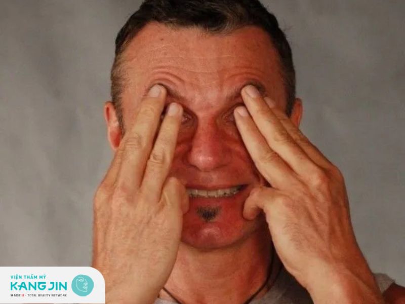 nâng cơ vùng mắt