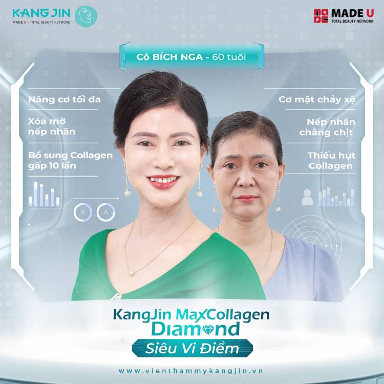 Liệu pháp nâng cơ trẻ hóa da mặt hiện đại mang lại hiệu quả rõ rệt