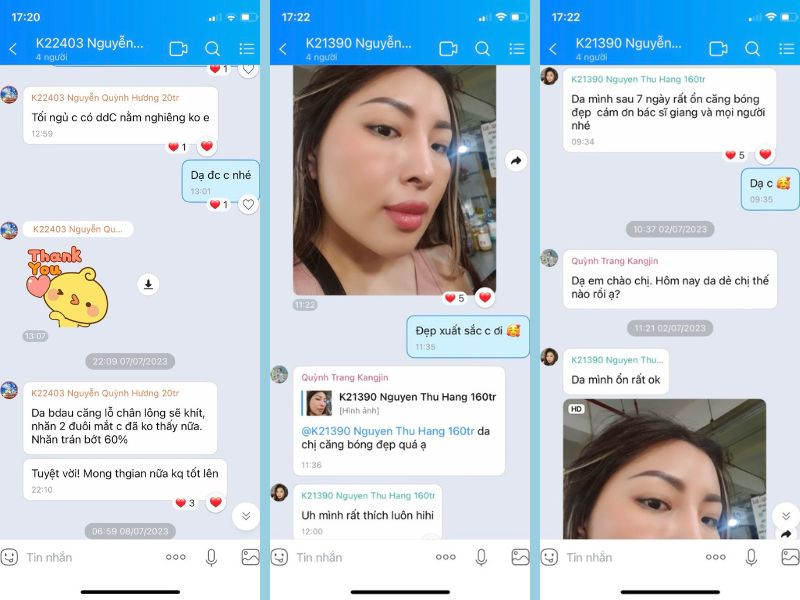 Phản hồi của khách hàng sau khi làm liệu trình trẻ hóa da tại VTM KangJin