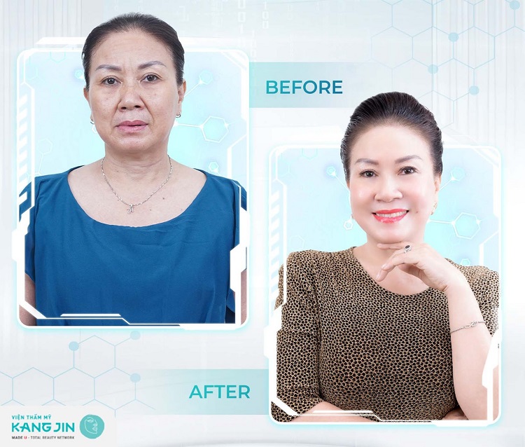 Kết quả mỹ mãn giúp cô Thanh Hoài vực dậy nhan sắc bị bỏ quên bao lâu nay Kết quả mỹ mãn giúp cô Thanh Hoài vực dậy nhan sắc bị bỏ quên bao lâu nay