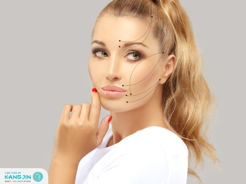 Review căng chỉ collagen