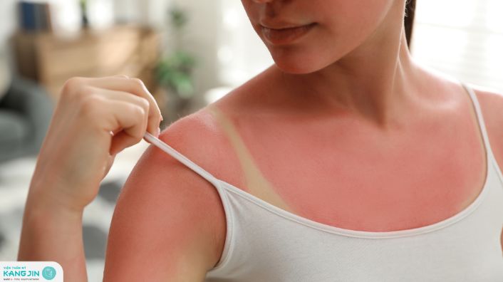 da bị cháy nắng sạm đen