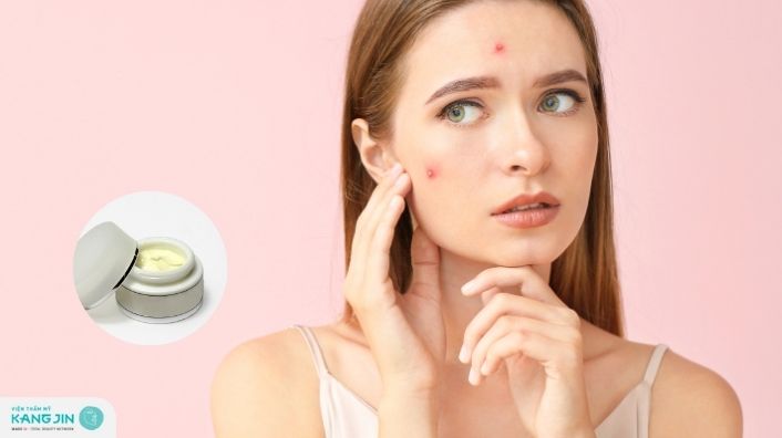 Da mụn có nên dùng kem dưỡng trắng không?