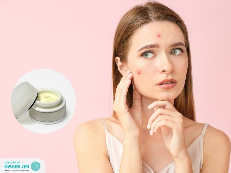 Da mụn có nên dùng kem dưỡng trắng không?