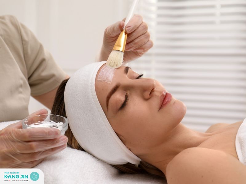 da mụn có nên peel da