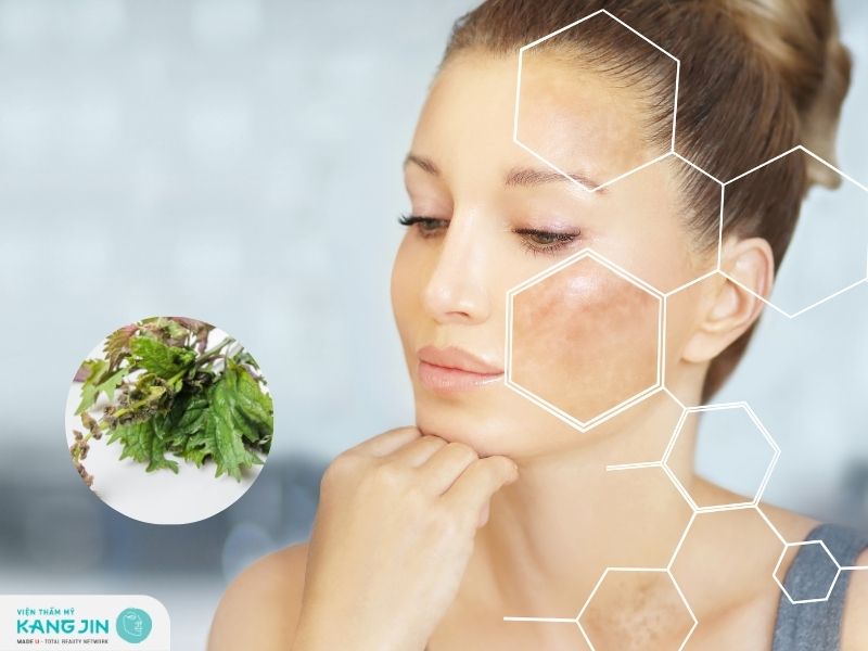 Tổng hợp các loại mặt nạ tía tô trị nám