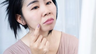 10 cách xoá rãnh cười tại nhà mang lại gương mặt trẻ trung