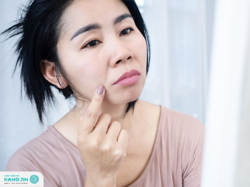 cách xoá rãnh cười tại nhà