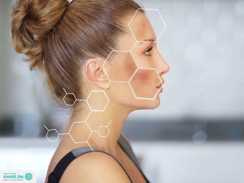 bôi retinol bị sạm da