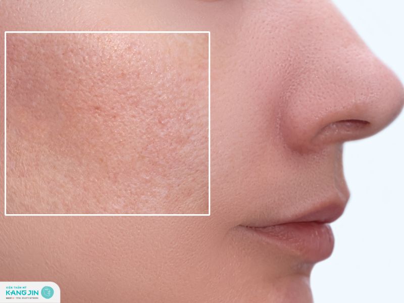 cách thu nhỏ lỗ chân lông ở mặt