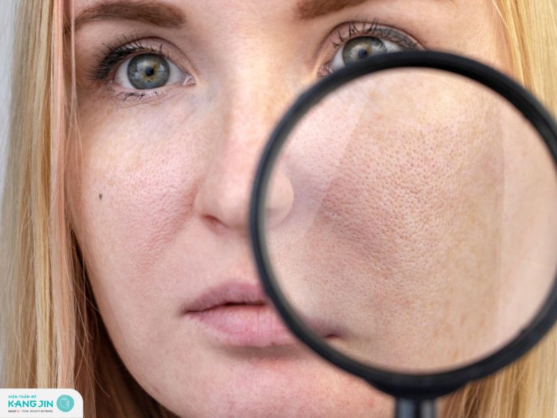 cách thu nhỏ lỗ chân lông ở mặt