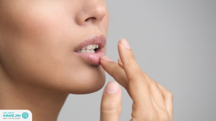 Có trị thâm môi dứt điểm được không?