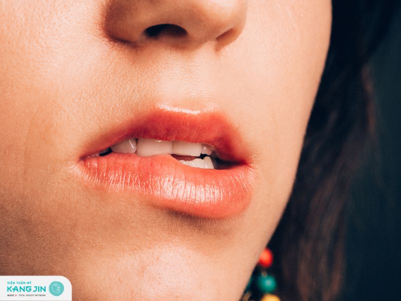 cách hết thâm môi