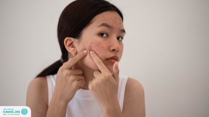 Mặt nạ trị thâm mụn hữu hiệu cho mọi làn da