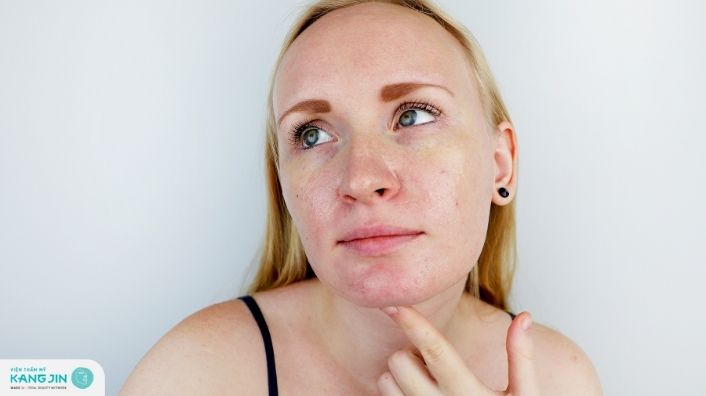 Khi sử dụng các sản phẩm dưỡng ẩm kiềm dầu bạn cần chú ý điều gì