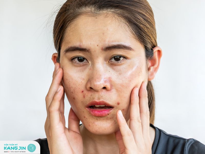 Cách lựa chọn nước hoa hòng dưỡng cho da dầu hiệu quả 