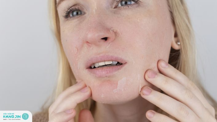 Cách hết nẻ mặt da hồng hào căng mịn