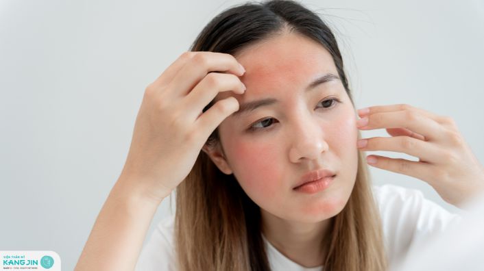 phục hồi da mỏng đỏ