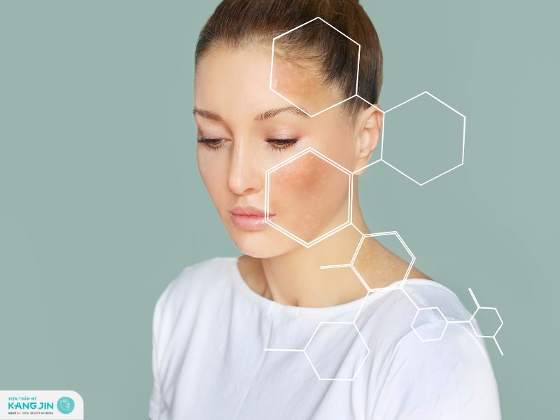 uống gì để giảm sắc tố melanin