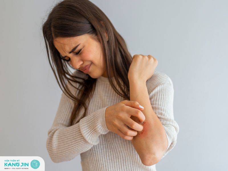 Cách trị viêm da tại nhà với các bước đơn giản