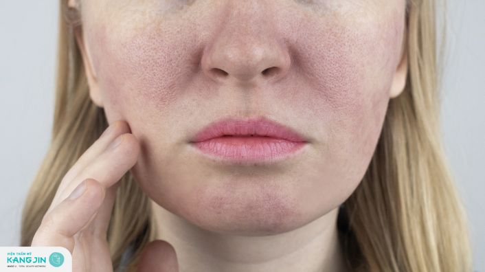 Uống gì để se khít lỗ chân lông?