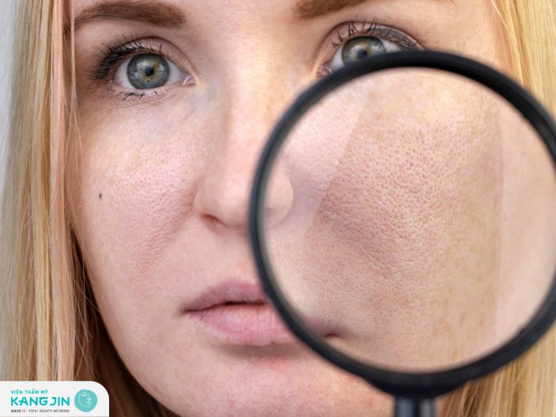 Uống gì để se khít lỗ chân lông to?