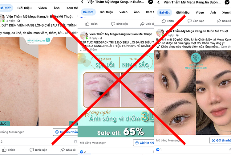 Các Fanpage sử dụng thương hiệu KangJin nhằm trục lợi