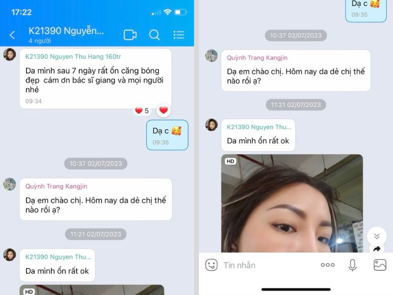 phản hồi tích cực của khách hàng sau liệu trình 