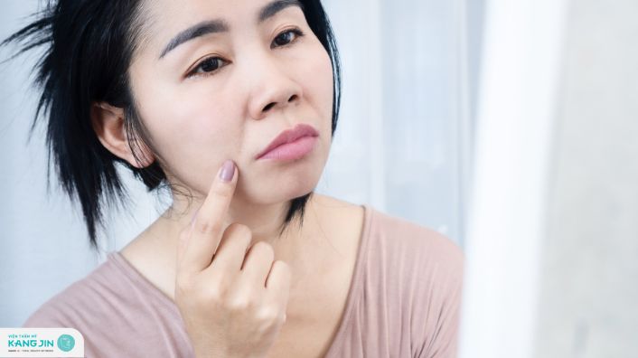 khắc phục rãnh cười sâu