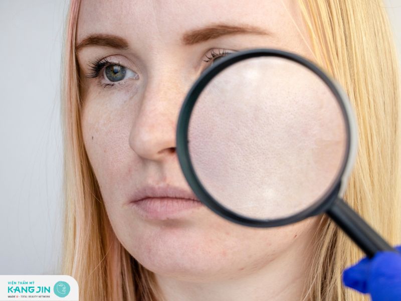 Lỗ chân lông to nên dùng gì để se khít hiệu quả