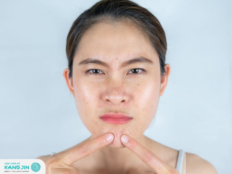 Lưu ý khi sử dụng chanh dưỡng trắng da mặt cho làn da dầu mà bạn nên biết