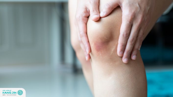 Cách trị thâm đầu gối đơn giản, hiệu quả