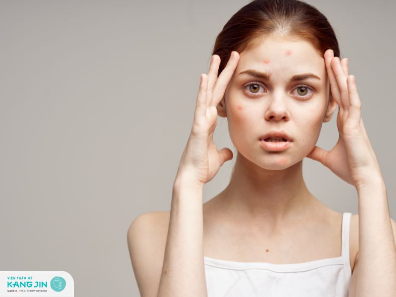 hoạt chất trị thâm mụn