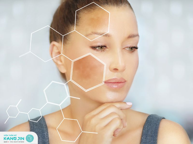 Bí quyết trị sạm da mặt tại nhà lấy lại làn da trắng sáng 