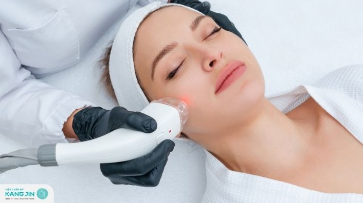 Trị thâm bằng Laser có đau không?