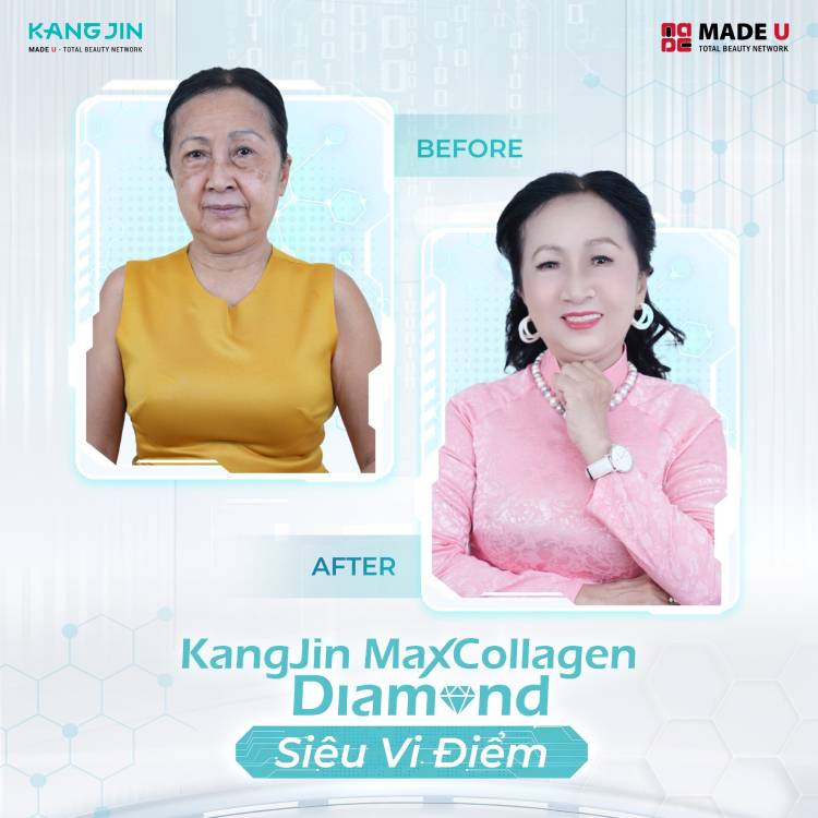 liệu pháp trẻ hóa da mặt hiện đại