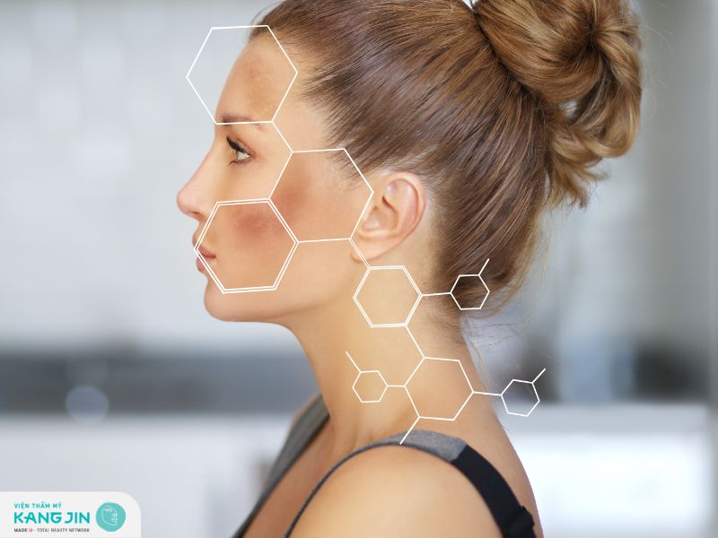 Hướng dẫn cách trị tàn nhang tận gốc hiệu quả 