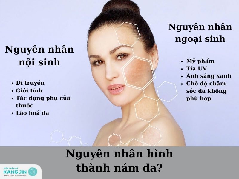 Nám da được hình thành do những nguyên nhân nào